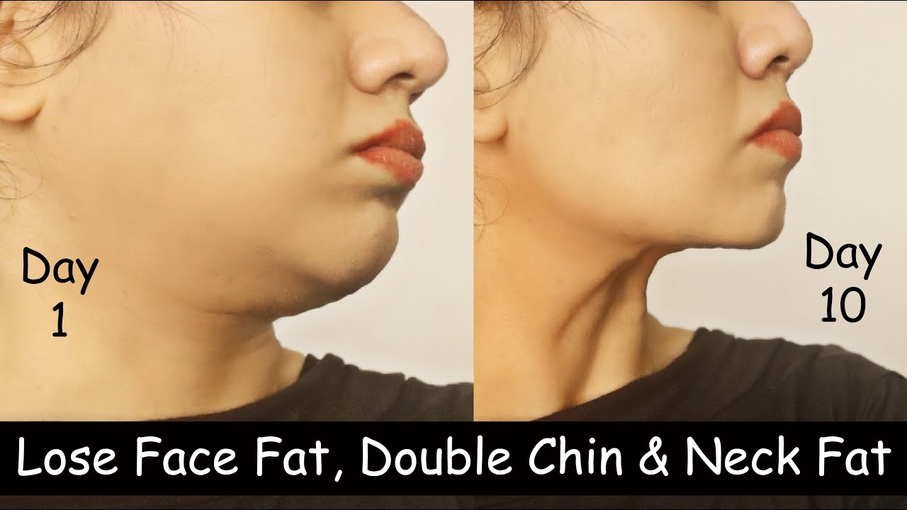 Diet Tips for Neck Fat Loss